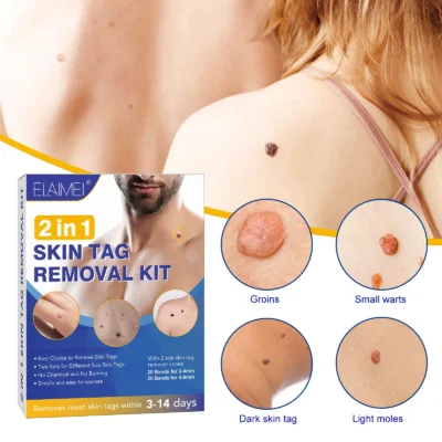 1 Set Auto Skin Tag Remover 2-8mm Band Painless Mole Wart Skin Tag Removal Pen Wart Dot Corn Treatments Body Facial Beauty Tool