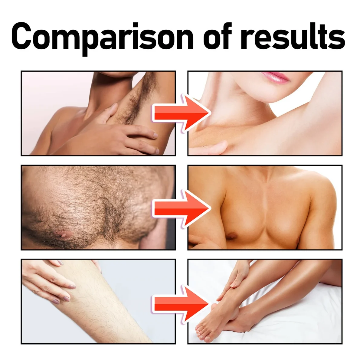Hair Removal Cream Underarm Lip Private Parts Gentle Depilator Inhibiting Hair Growth Smooth Painless Shaving Depilatory Cream
