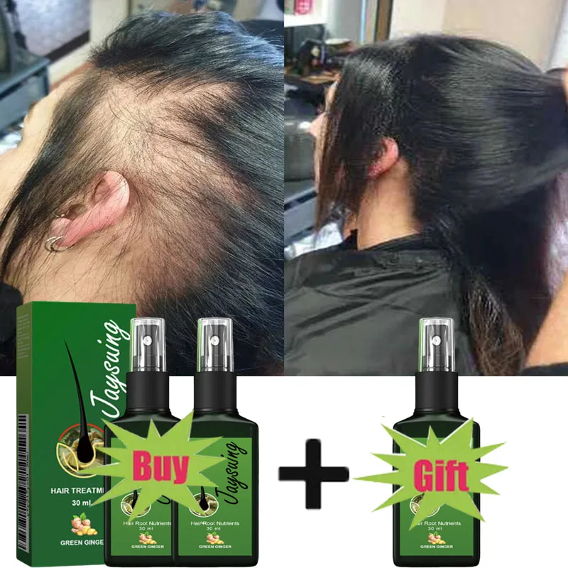 Fast Hair Growth Serum Spray Anti Hair Loss Prevent Baldness Scalp Treatment Repair Roots Beauty Health Hair Care For Men Women