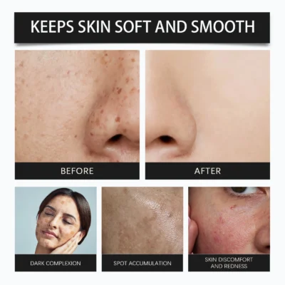 For 345 Relief Cream Address Blemishes Nourish The Skin And Provide Soothing Care Resulting In A Well-Rounded Skincare Solution