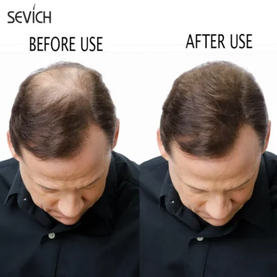 Sevich 500g Refill Hair Fiber Anti Hair Loss Product 10Color Keratin Instant Hair Growth Fiber Refill Hair Building Fiber Powder