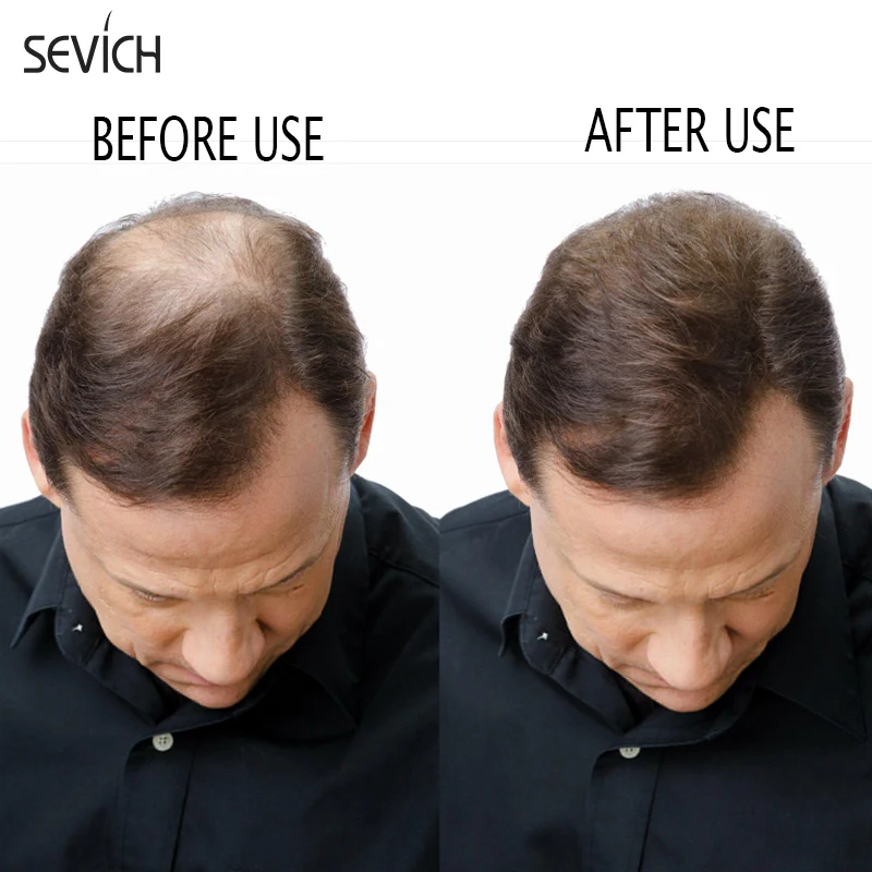 Sevich 500g Refill Hair Fiber Anti Hair Loss Product 10Color Keratin Instant Hair Growth Fiber Refill Hair Building Fiber Powder
