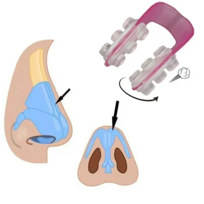 Nose Shaper Nose Up Shaping Machine Lifting Bridge Straightening Nose-Clip Face Lift Nose-Up Clip Facial Corrector Beauty Tool
